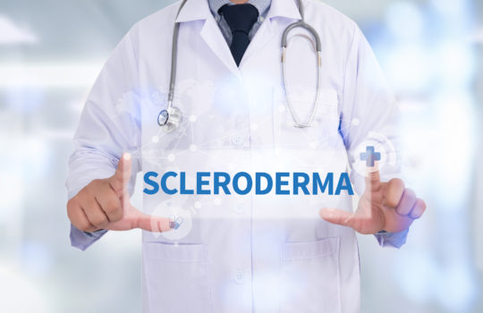 Scleroderma massage Seattle